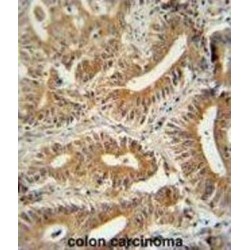 Coiled-Coil Domain-Containing Protein 123 (CCDC123) Antibody