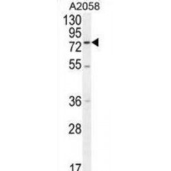 ENTH Domain-Containing Protein 1 (ENTHD1) Antibody
