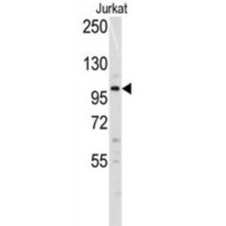 DNA Methyltransferase 3 Alpha (Dnmt3a) Antibody