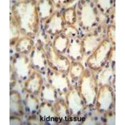Potassium Channel Subfamily T Member 2 (KCNT2) Antibody