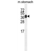 WB analysis of Mouse stomach tissue lysate (35 µg), using Synaptotagmin-8 (SYT8) antibody. Synaptotagmin-8 (SYT8) detection is demonstrated by the arrow.