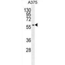 Speedy Protein E3 (SPDYE3) Antibody