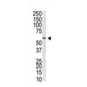 Methyl-CpG Binding Domain Protein 1 (MBD1) Antibody