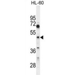 Choline/Ethanolaminephosphotransferase 1 (CEPT1) Antibody