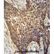 Methyltransferase Like Protein 4 (METTL4) Antibody