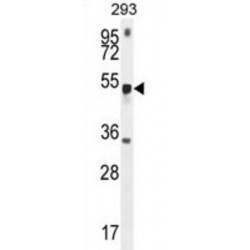 Methyltransferase Like Protein 4 (METTL4) Antibody