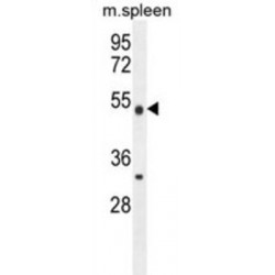 Methyltransferase Like Protein 4 (METTL4) Antibody