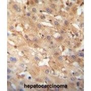 Sialidase 4 (NEU4) Antibody