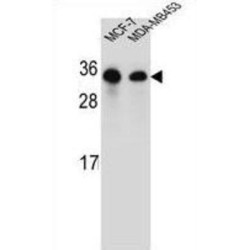 GTP-Binding Protein SAR1b (SAR1B) Antibody