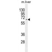 Kyphoscoliosis Peptidase (KY) Antibody