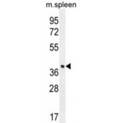 Tetraspan Membrane Protein of Hair Cell Stereocilia (LHFPL5) Antibody