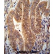 KIAA1644 Antibody