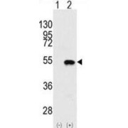 SET And MYND Domain-Containing Protein 2 (SMYD2) Antibody
