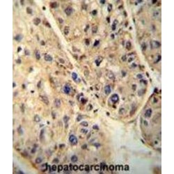 ATP Binding Cassette Subfamily D Member 1 (ABCD1) Antibody