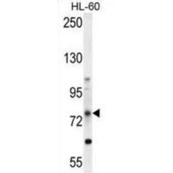 ATP Binding Cassette Subfamily D Member 1 (ABCD1) Antibody