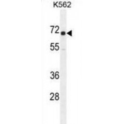 Insulin Like Growth Factor 2 mRNA Binding Protein 1 (IGF2BP1) Antibody