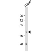 GNA15 Antibody (C-term) at 1:1000 dilution + human liver lysate Lysates/proteins at 20 µg per lane. Secondary Goat Anti-Rabbit IgG, (H+L), Peroxidase conjugated at 1/10000 dilution. Predicted band size: 44 kDa Blocking/Dilution buffer: 5% NFDM/TBST.