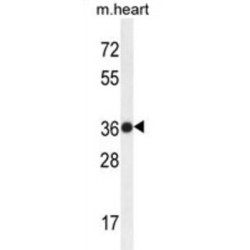 Transmembrane BAX Inhibitor Motif Containing 4 (TMBIM4) Antibody