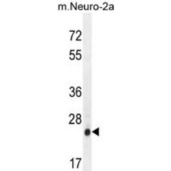 AP-3 Complex Subunit Sigma-1 (AP3S1) Antibody