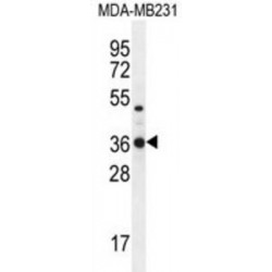Tryptase Delta (TPSD1) Antibody