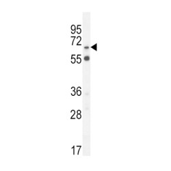 S6A12 Antibody