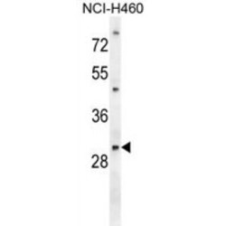 Phosphoglycerate Mutase 2 (PGAM2) Antibody