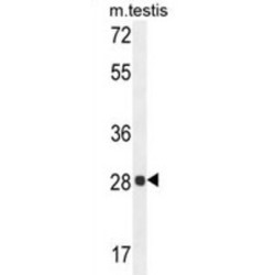 Phosphoglycerate Mutase 2 (PGAM2) Antibody