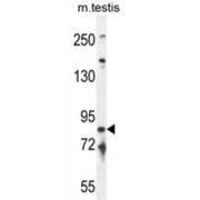 abx025757