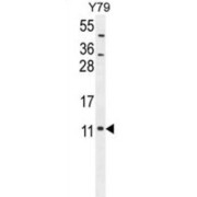 WB analysis of extracts of Y79 cell line lysates (35 µg/lane), using NDUAB Antibody.