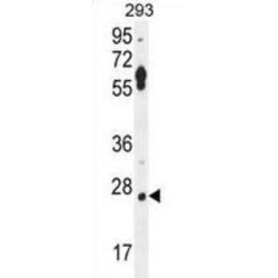 Leucine Rich Repeat Containing 57 (LRRC57) Antibody