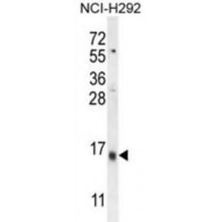 Lymphocyte Antigen 6 Complex Locus Protein G6c (LY6G6C) Antibody