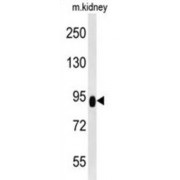 Zinc Finger And BTB Domain-Containing Protein 41 (ZBTB41) Antibody