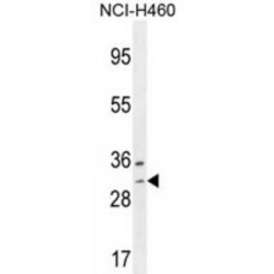Williams-Beuren Syndrome Chromosomal Region 27 Protein (WBSCR27) Antibody