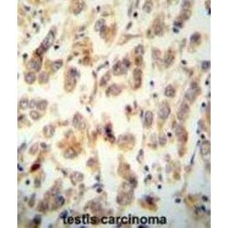 Tetratricopeptide Repeat Protein 16 (TTC16) Antibody