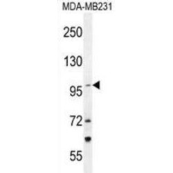 Tetratricopeptide Repeat Protein 16 (TTC16) Antibody