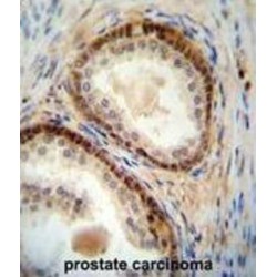 Nudix Hydrolase 8 (NUDT8) Antibody