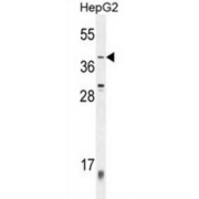 Zinc Finger Protein 763 (ZNF763) Antibody