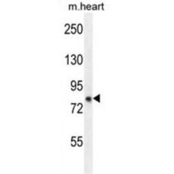 Zinc Finger FYVE-Type Containing 28 (ZFYVE28) Antibody