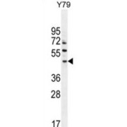 Lactation Elevated Protein 1 (LACE1) Antibody