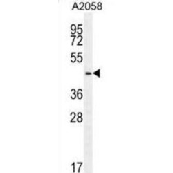 WD Repeat-Containing Protein 21C (WDR21C) Antibody