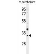 Olfactory Receptor Family 51 Subfamily I Member 1 (OR51I1) Antibody
