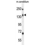 CD109 Antigen (CD109) Antibody