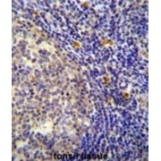 Carbohydrate Deacetylase (YDJC) Antibody