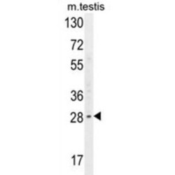 Carbohydrate Deacetylase (YDJC) Antibody