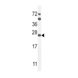 Sodium Voltage-Gated Channel Beta Subunit 1 (SCN1B) Antibody