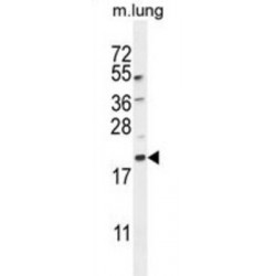 Microtubule-Associated Proteins 1A/1B Light Chain 3B (MAP1LC3A/B) Antibody