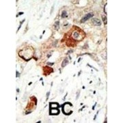 abx025821