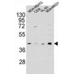HERV-H LTR-Associating Protein 2 (HHLA2) Antibody