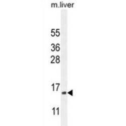 Complexin-3 (CPLX3) Antibody