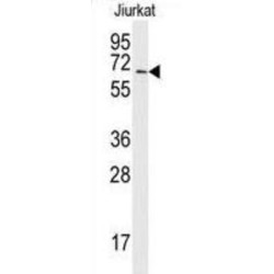 SUMO-Activating Enzyme Subunit 2 (SAE2) Antibody